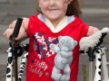 2. 7-летняя девочка начала ходить после 76 операций