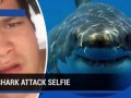 Shark attack victim takes graphic selfie video after attack in Hawaii - TomoNews