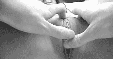 1 (24)