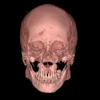 scull3416511