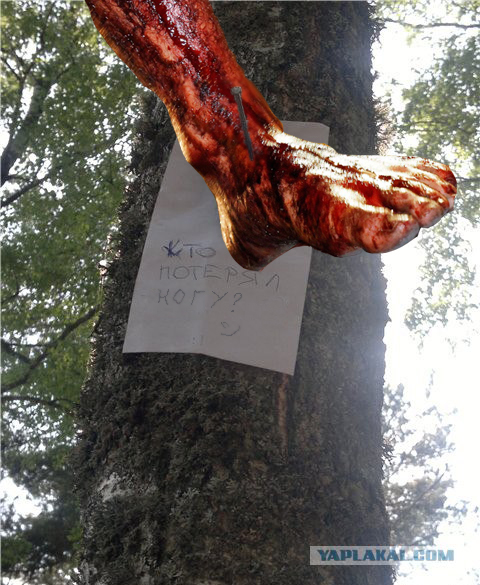 Нога потерянна