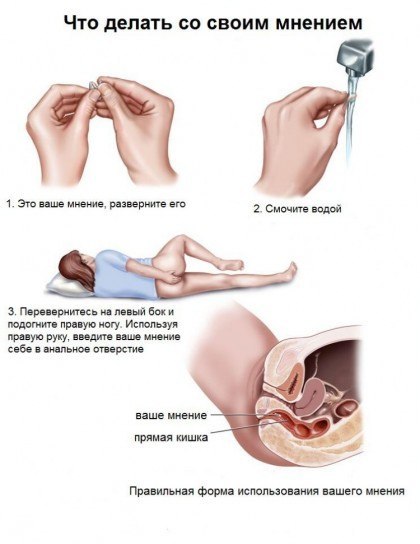 что делать с мнением