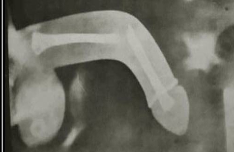 вялый пипан