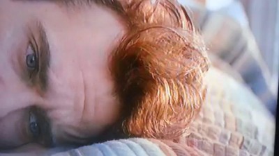 Joaquin Phoenix's Forehead