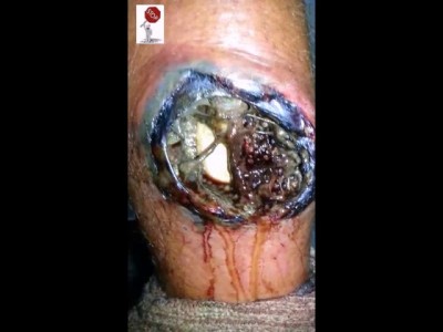 Опухла нога немного ...