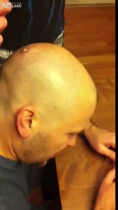 В голове у мужика какойто зверь