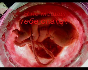 АБОРТ---Cтих  не родившегося ребенка.