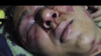 Зашили глаза ...