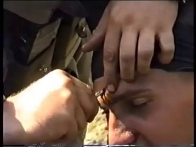 у русского солдата застряла пуля во лбу!A Russian soldier splinter in his forehead!!!