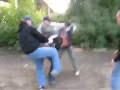 Выбили глаз