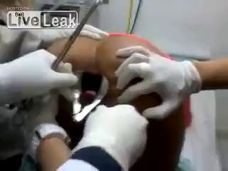 Всякое из жопы вынимают