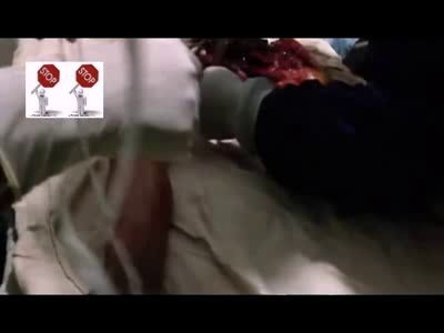 Хирурги пытаются спасти ногу ...