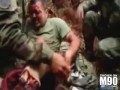 Противопехотная мина отрывае ногу колумбийского солдата