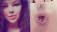 The face of Juicypussy2288 and her anal prolapse